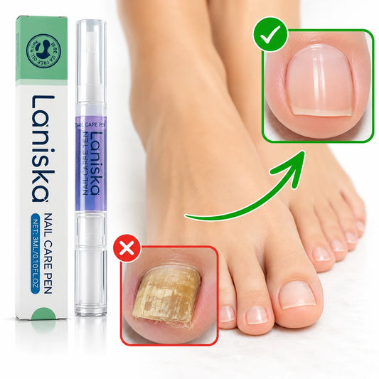 FINALLY REACH THE SOURCE OF YOUR NAIL FUNGUS